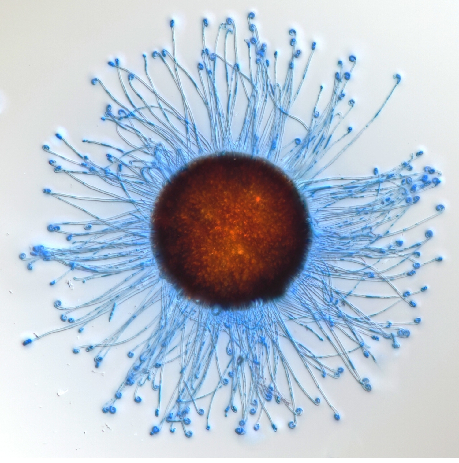 A microscopic image of the sexual structure of a powdery mildew with a dark orange and brown center with a halo of light blue tendrils around it.